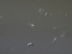 Human sperm swimming, Interference contrast Stock Footage