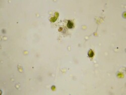 Microorganisms swimming fast Stock Footage