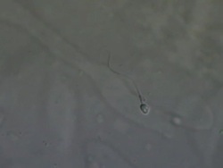 Single Human sperm swimming, Interference contrast Stock Footage