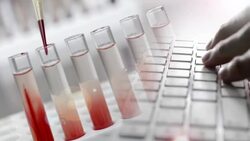 typing computer with laboratory Stock Footage