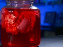 Medium Close Up_static - A glass jar holds a human organ suspended in red liquid.   Stock Footage