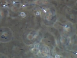 Human sperm, lots swimming around, pan across Stock Footage