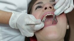 Mending patient's teeth Stock Footage