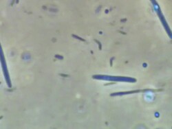 Human tongue bacteria from Human tongue scrape. Recorded using Phase Contrast illumination, horizontal field of view 50 micrometres. Stock Footage