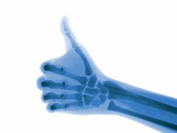 Blue X-ray thumbs up in slow motion Stock Footage