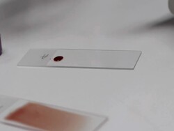 blood smear Stock Footage