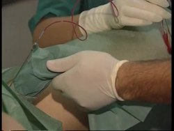 Debate rages over new law on access to fertility treatments News Clip