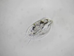 Microorganism - Euplotes Stock Footage