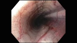 An endoscope views a snake's digestive tract. Stock Footage