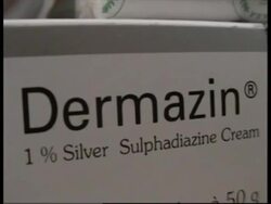 Medical teams on standby in case volcano erupts News Clip