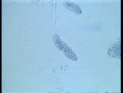 WA microscopic view of two Paramecium conjugating Stock Footage