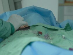 Operating room. Surgeon collects blood into syringe Stock Footage