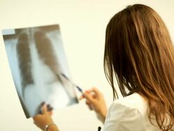 Doctors consult over an X-ray Stock Footage