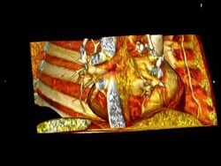 3D Heart Stock Footage