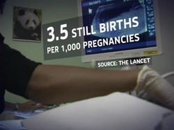 Too Many Still Born Deaths Unexplained News Clip