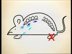 Israel - Breakthrough in spinal treatment News Clip