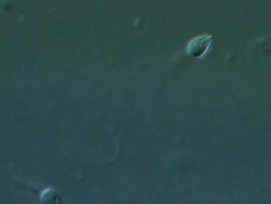 Single Human sperm swimming, big close up, Interference contrast Stock Footage