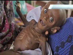 Only 10 days ago, a severely malnourished infant who was brought into a field hospital seemed likely to join the more than 29,000 Somali children who have already died in the country''s worst famine in decades.  But, now doctors say his health is improving . News Clip
