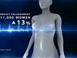 Rise in Popularity of Cosmetic Surgery News Clip