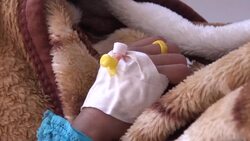 WHO addresses cholera outbreak in Yemen News Clip