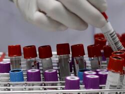 scientist keep a blood tube Stock Footage