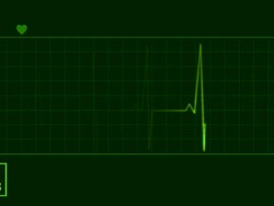 EKG electrocardiogram pulse trace heart monitor Stock Footage