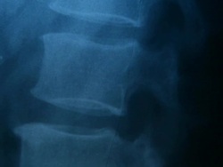 X-ray (HD) Stock Footage