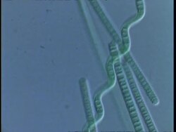 T/L blue green algae filaments moving; procaryote cell (Oscillatoriales) Stock Footage