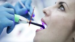 Dental curing ultraviolet light equipment Stock Footage