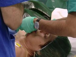 MS Patient being put to sleep with anesthesia / Cagliari, Sardinia, Italy Stock Footage