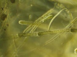 Microscopic worms, plants Stock Footage