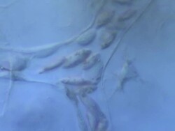 Blood cells moving through capillaries of tail of tadpole of Toad Bufo bufo Stock Footage