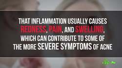 How Do You Get Rid of Acne? Instructional Video