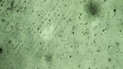Microorganisms Stock Footage