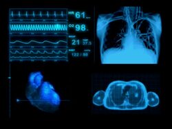 Computer Animation EKG Medical Display Monitor Stock Footage