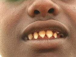 Boy's pointed teeth after ritual Stock Footage