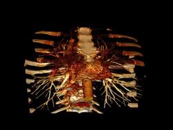 Body In Motion Stock Footage