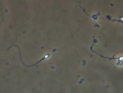 Single Human sperm swimming, Phase contrast Stock Footage