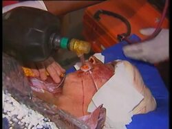 ZIMBABWE: WHITE FARMER BADLY BEATEN BY BLACK SQUATTERS News Clip