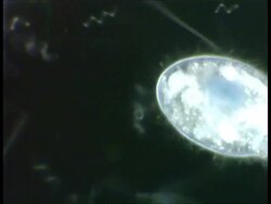 Ciliates, Spirochaeta and other bacteria moving in pond water. Dark Field Stock Footage