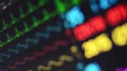 Vital signs monitor Stock Footage