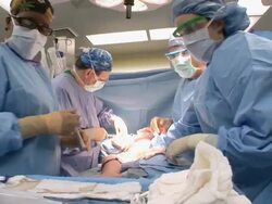 MS  Doctor bandages on child's burnt wounds  /  Little Rock, Arkansas, USA Stock Footage