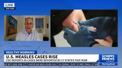 CDC sends team to Chicago for measles outbreak tied to migrant center News Clip