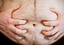 Obesity - Global Health Issue Instructional Video