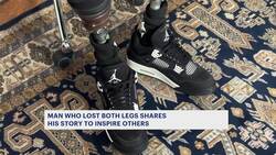 Survivor of double leg amputation shares his story to inspire others facing hardships News Clip