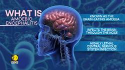 9-year-old Dead From Rare Brain Infection Due to Amoebic Encephalitis News Clip