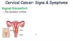 Cervical Cancer Signs & Symptoms (& Why They Occur) Instructional Video