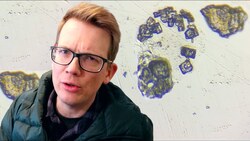 I Didn't Clean My Glasses for a Week and then I Put them Under a Microscope Instructional Video