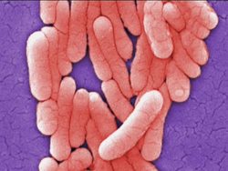 Prokaryotes: Introduction Instructional Video