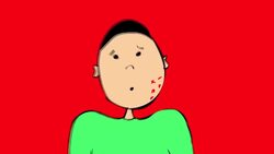 How to Use an Epinephrine Auto-Injector Instructional Video